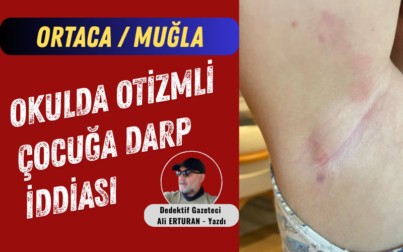 Gün geçmiyor ki Türkiye’de otizmli çocuklara yönelik şiddet iddiaları gündeme