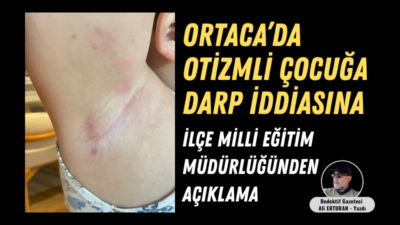 Muğla’nın Ortaca ilçesinde 7 yaşındaki otizm tanılı M.A.Ö.’nün darp edildiği