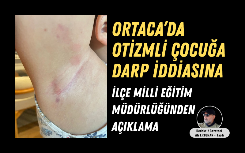 Muğla’nın Ortaca ilçesinde 7 yaşındaki otizm tanılı M.A.Ö.’nün darp edildiği